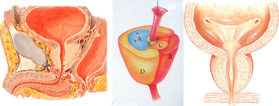 hiperplasia prostática benigna